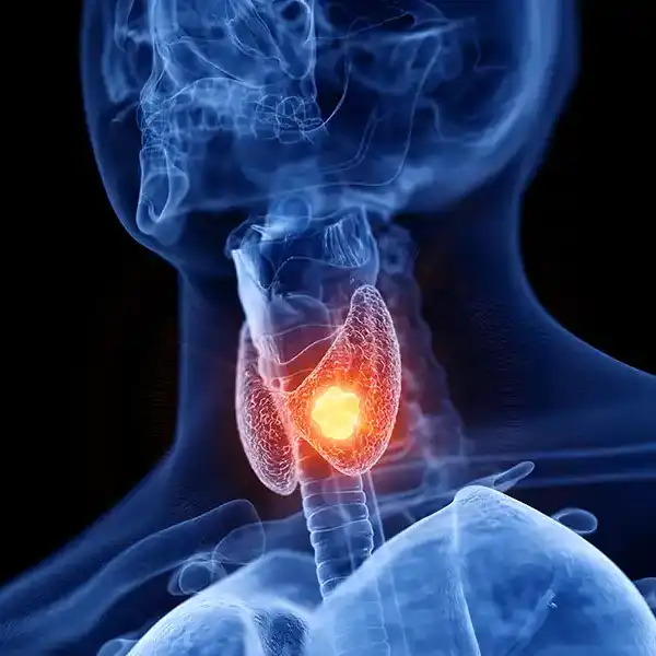 Thyroid Thyroid